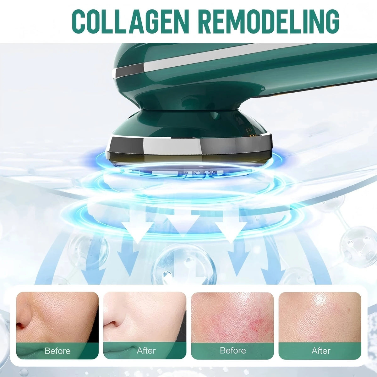 Dispositivo Facial de microcorriente, máquina de Estiramiento Facial, masajeador para apretar la piel del cuello, herramienta de belleza para rejuvenecimiento de vibración de fotones con luz LED