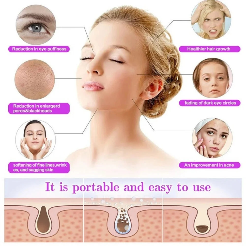 Dispositivo portátil de electroterapia de microcorriente y de alta frecuencia, eliminación de acné y peine de belleza